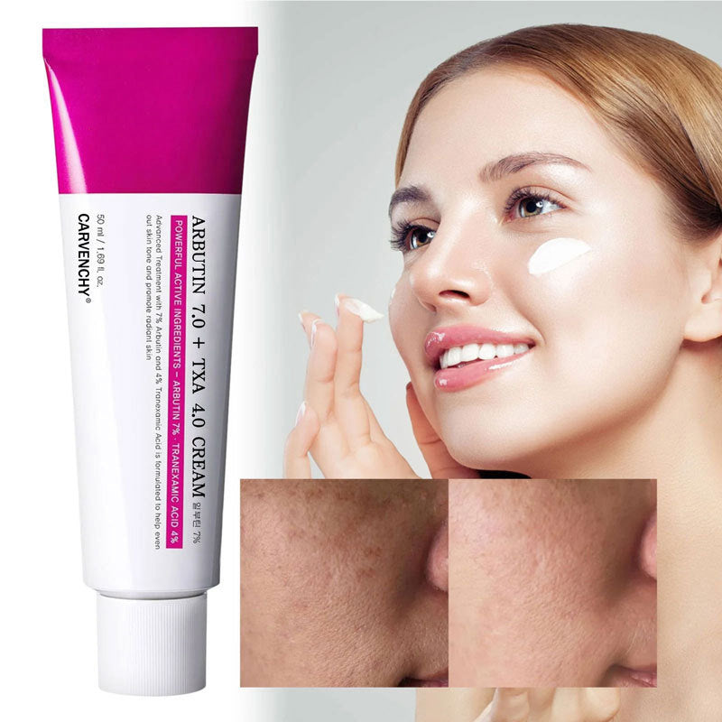 Arbutin 7% + TXA 4% Face Cream | 50ml Daily Skincare
